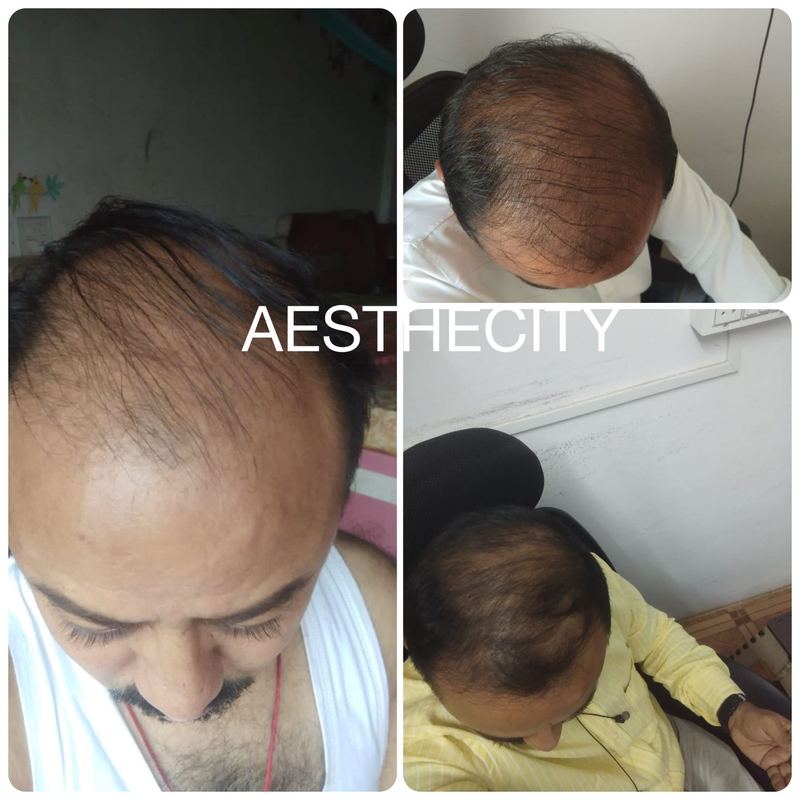 Hair treatment results